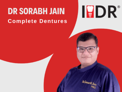 Complete Dentures